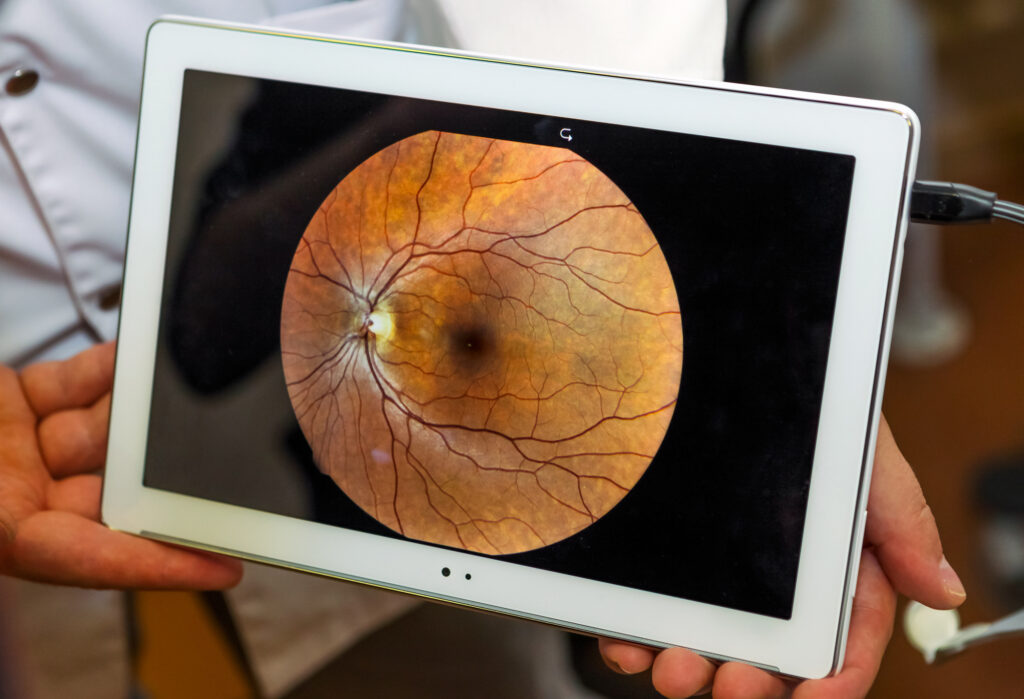 woman unergo eyes test. ocular fundus. visit to the doctor.